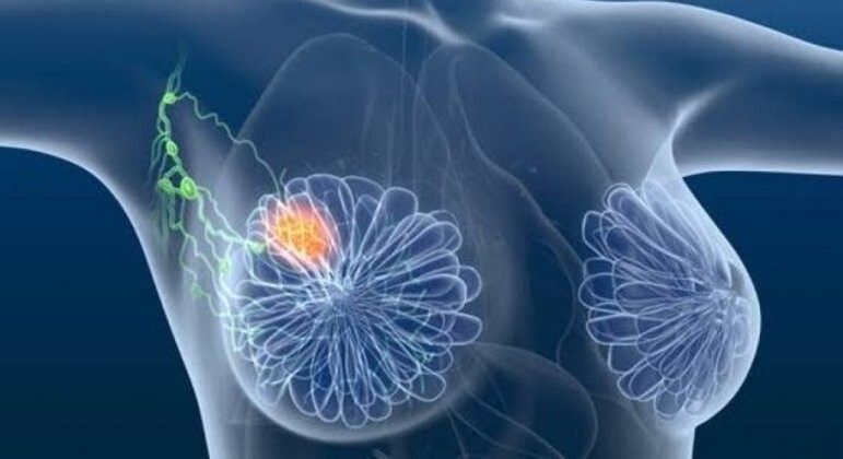 coren-am-promove-palestra-sobre-abordagem-qualificada-para-o-rastreamento-precoce-do-cancer-de-mama-nesta-quinta-feira27